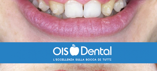 OIS Dental